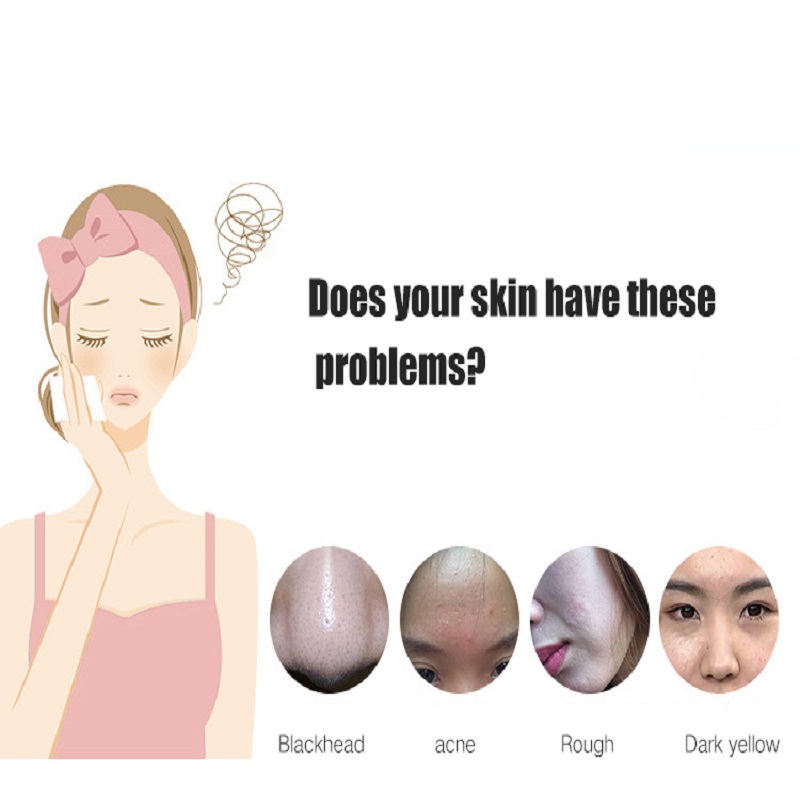 Deep Cleansing Exfoliators Skin Rejuvenation Face Lift Facial Ultrasonic Skin Scrubber